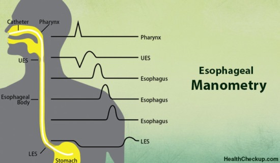 Esophageal Motility Study Archives Health CheckUp