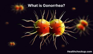 Gonorrhea Symptoms Diagnosis Treatment Prevention