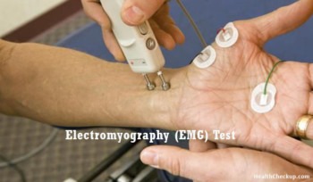 what does nr mean on an emg test painful