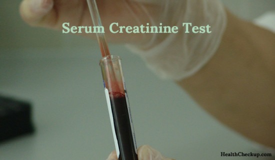 creatinine istat results