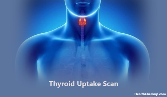 radioactive-iodine-therapy-for-hyperthyroidism