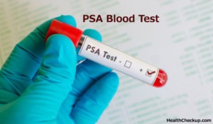 PSA Blood Test Preparation & Normal Ranges | Healthcheckup