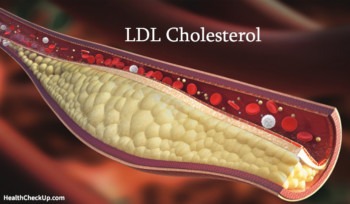 ldl cholesterol range 27 years old