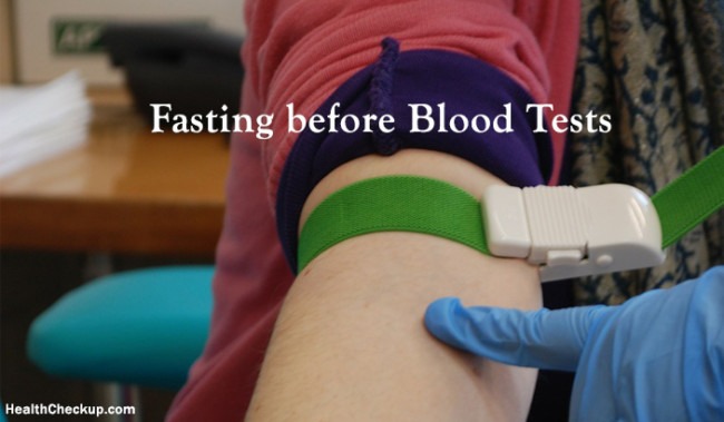 fasting-before-blood-tests-your-questions-answered-health-checkup