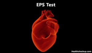 EPS Test Procedure & Risks | Intracardiac Electrophysiology Study