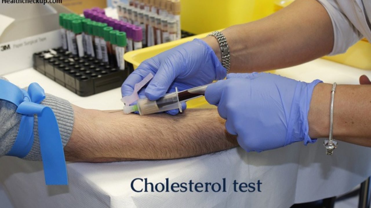 Preparation, Cholesterol Interpretation Results Test Procedure,