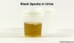 What Causes Black Specks In Urine?