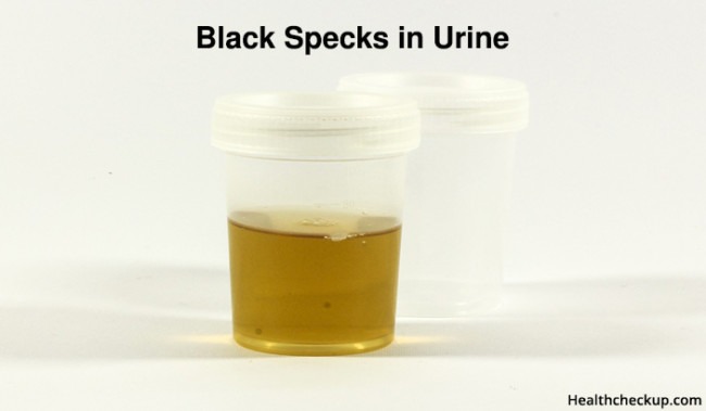 What Causes Black Specks In Urine?