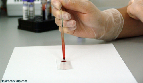 Blood Grouping Test : Principle, Purpose And Procedure | Health Checkup