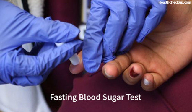 How To Prepare For Fasting Blood Sugar Test