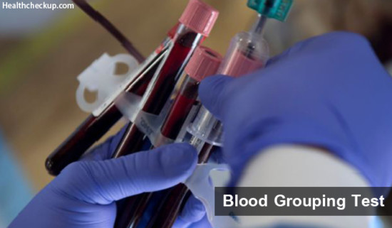 Blood Grouping Test : Principle, Purpose And Procedure | Health Checkup