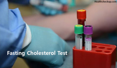 cholesterol fasting significance