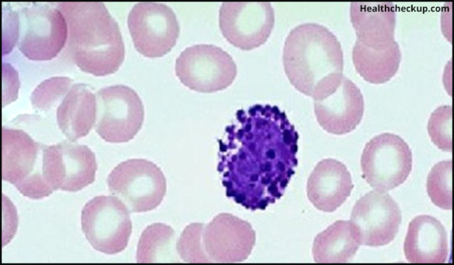 basophils-blood-test-normal-range-causes-of-high-low-basophil-count