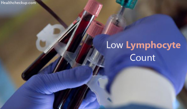 low-lymphocyte-count-causes-symptoms-normal-ranges-treatment