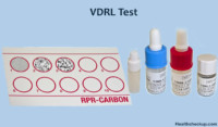 What is a VDRL Test : Procedure, Purpose, Results, Interpretation