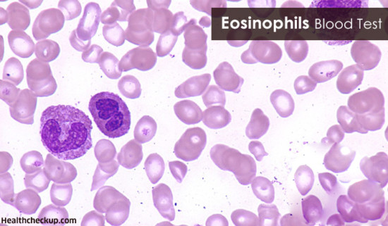 eosinophils-blood-test-procedure-causes-of-eosinophilia-and-treatment