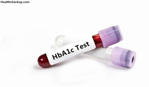 Hba1c Test Procedure Normal Ranges Low And High Hba1c Results