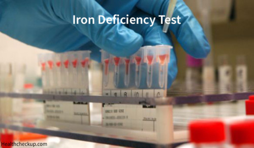 iron-deficiency-test-procedure-iron-deficiency-causes-and-symptoms