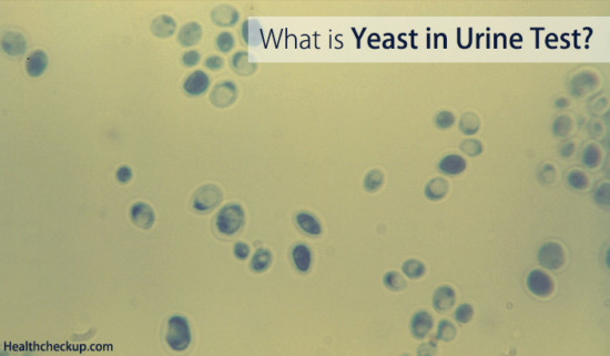 yeast in urine test what does yeast cells in urine mean