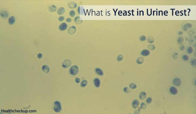 Yeast in Urine Test | What Does Yeast Cells in Urine Mean?