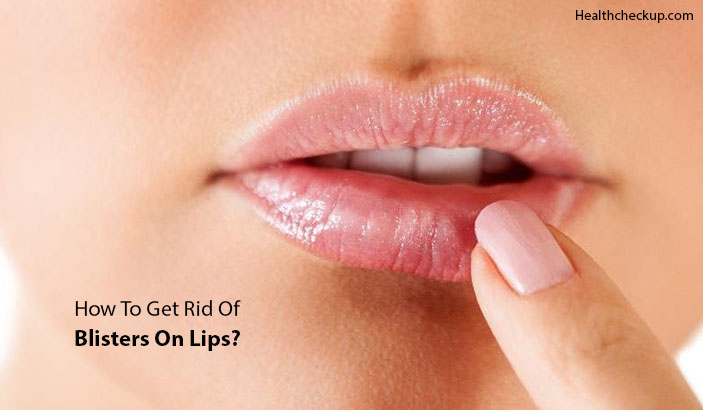 Causes Of Blisters On Lips How To Get Rid Of Blisters On Lips 