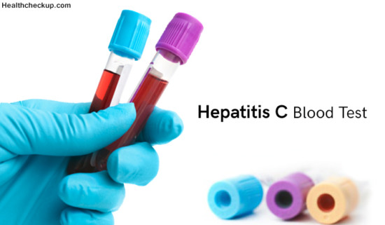 Hepatitis C Blood Test (Top 7 Things to Know about Hepatitis C Test)