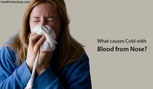 Why Do You Get A Cold With Bloody Nose? - Health Checkup