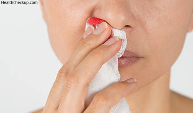 why-do-you-get-a-cold-with-bloody-nose-health-checkup