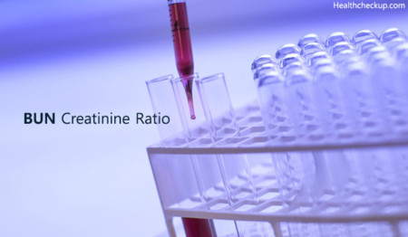 buncreatinine ratio normal range