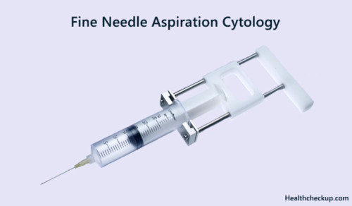 fine-needle-aspiration-cytology-preparation-procedure-results