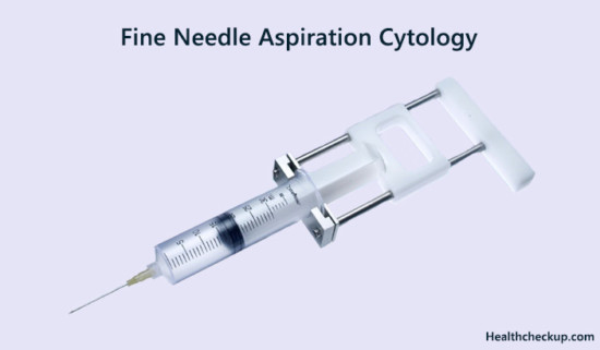 Fine Needle Aspiration Cytology Preparation Procedure Results