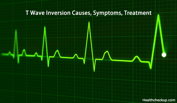 T Wave Inversion Causes Symptoms And Treatment Health CheckUp