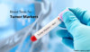 What Are Cancer Markers | Blood Tests for Cancer Markers