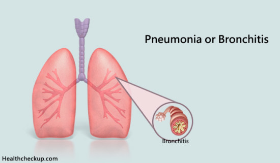 How Do You Know If You Have Pneumonia or Bronchitis by Dr Himanshi