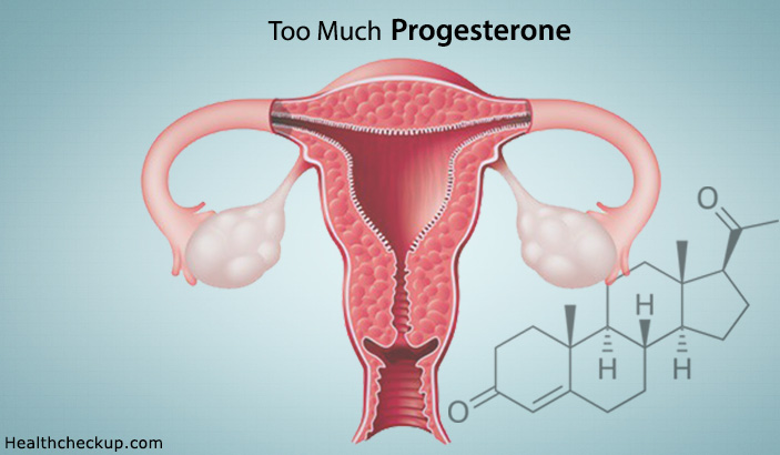Too Much Progesterone Symptoms Causes Side Effects