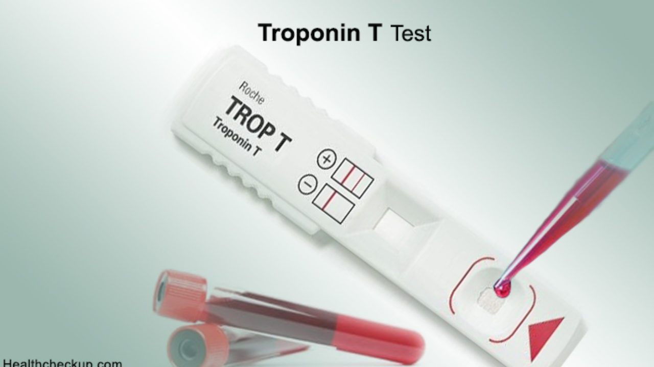 Тропонин анализ цена. Тропонин/тропониновый тест. Экспресс тест на тропонин. Экспресс метод тропонина. Тест на инфаркт миокарда тропонин.