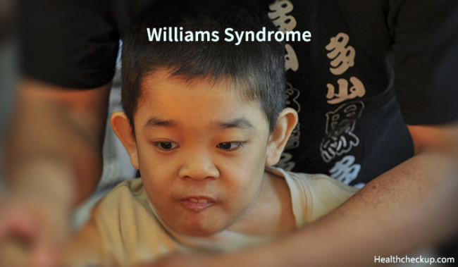 williams-syndrome-life-expectancy-causes-symptoms-treatment