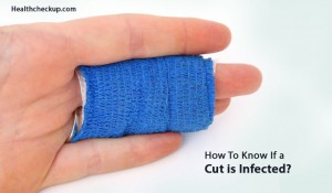 How to know If a Cut is Infected | Treatment, Healing Process of a Cut