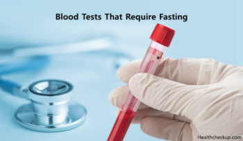 Which Blood Tests Require Fasting | Fasting Time For Blood Tests