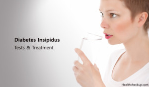 Diabetes Insipidus Tests Treatment 300x175 