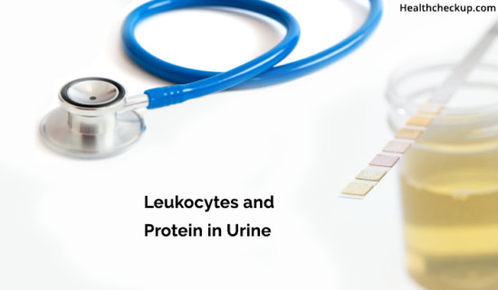 Leukocytes And Protein In Urine Meaning Causes Symptoms Treatment 6341