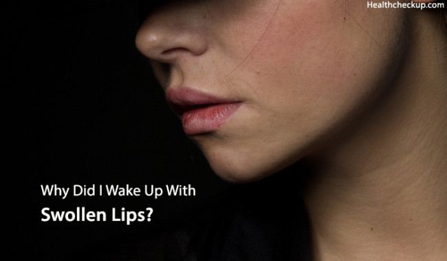 woke-up-with-swollen-lips-causes-treament-and-home-remedies