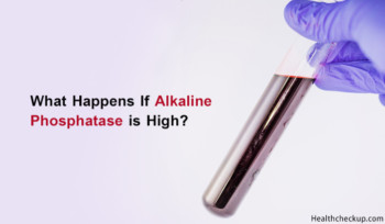 Alkaline Phosphatase High Symptoms, Causes, Treatment