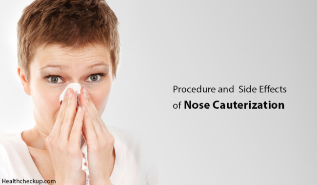 Precautions, Procedure and Side Effects of Nose Cauterization