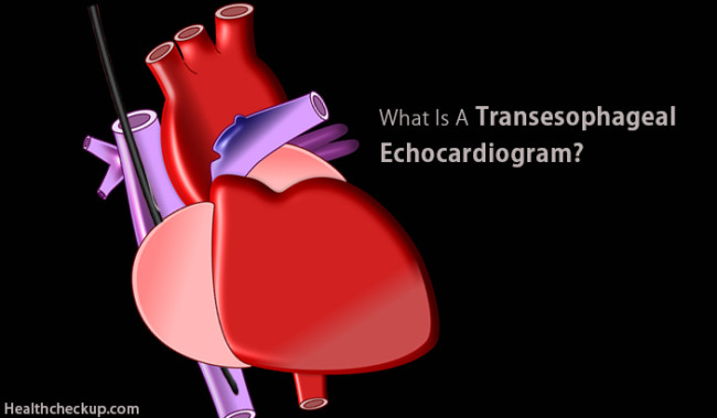 transesophageal-echocardiogram-tee-preparation-procedure-views