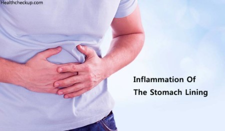 Inflammation of Stomach Lining (Gastritis) Symptoms, Causes, Treatment