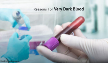 Why Is My Blood So Dark And Red - What Does It Mean And Causes