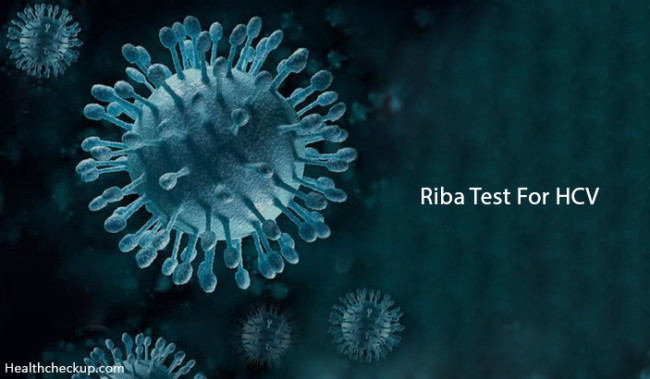 (recombinant Immunoblot Assay) Riba Test For Hcv - Principle, Procedure 