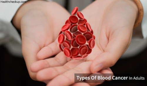 types-of-blood-cancer-in-adults-health-checkup