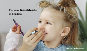 Frequent Nosebleeds in Children - Causes, Symptoms, Treatment, Tips